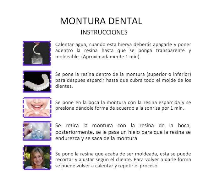 Implantes dentales (Superior+Inferior)